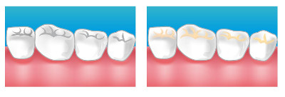 soins dentaire dentiste blanc mesnil