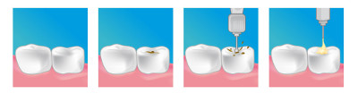 soins dentaires centre dentaire blanc mesnil